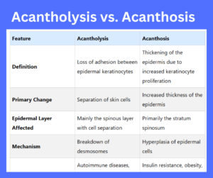 Acantholysis vs. Acanthosis key differences explained
